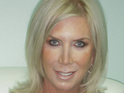 Liquid Facelift After Pic